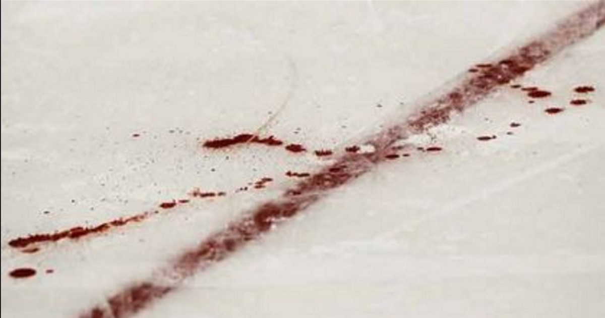 Man shot in the head after argument during children's hockey game.