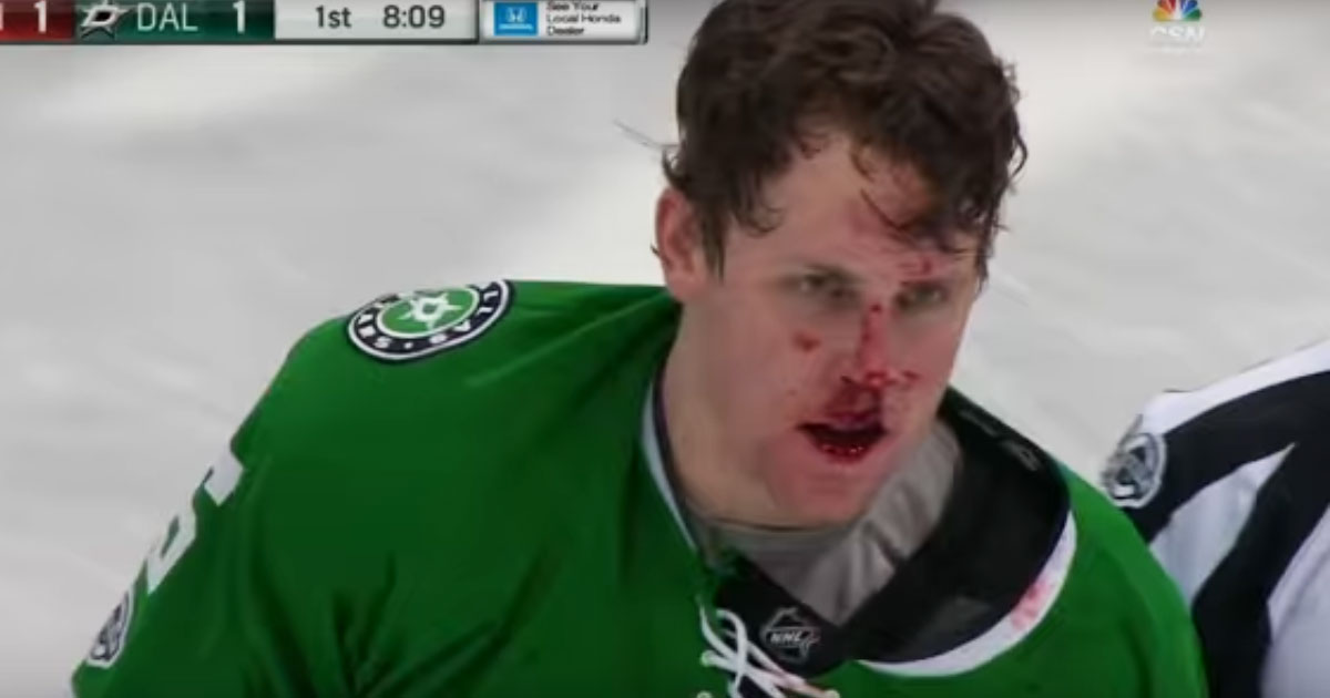 Big Ol' scrap leaves Brett Ritchie bloodied!