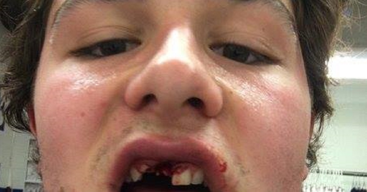 THIS is why you have to be tough to play hockey!! (PHOTO INSIDE!)