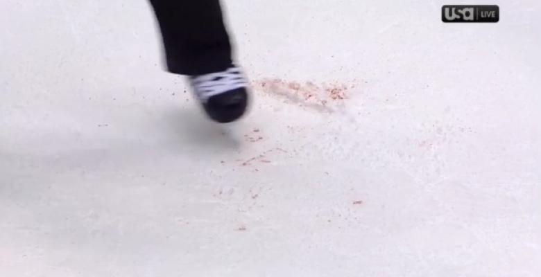 (VIDEO): Brooks Orpik takes a skate and a beer to the face!