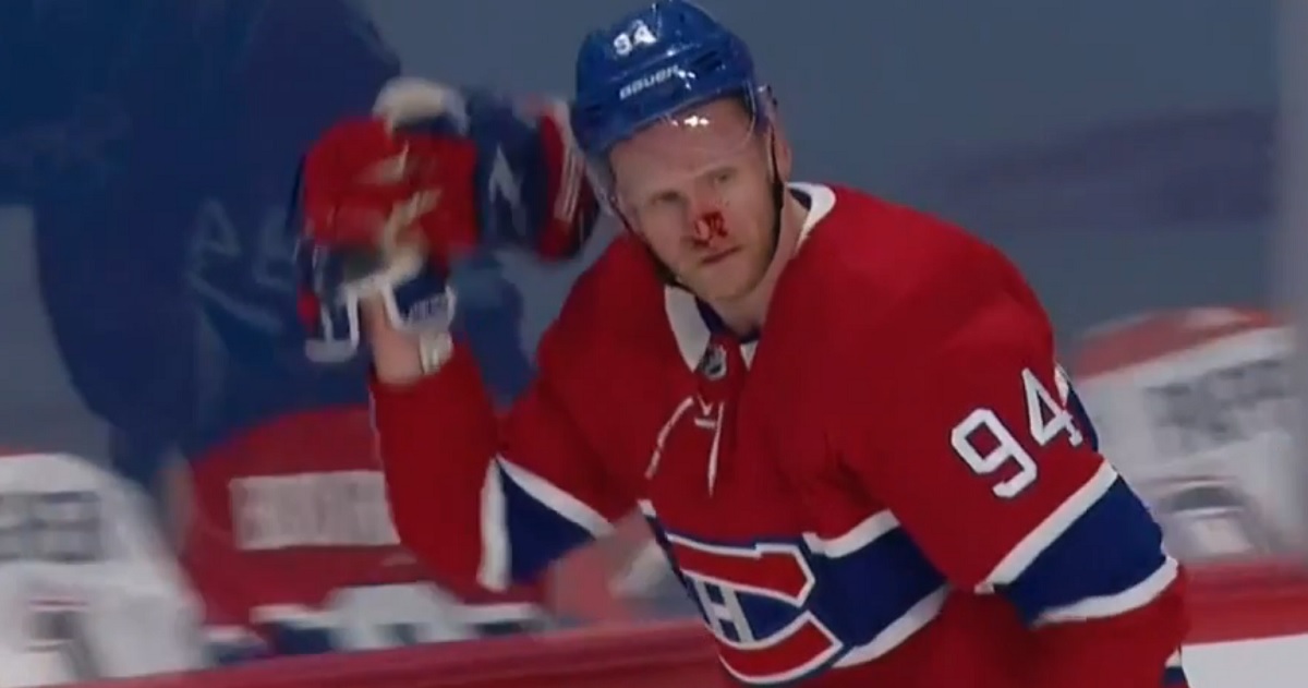 Rewind: Four officials miss a blatant, and bloody, high stick on Corey Perry.