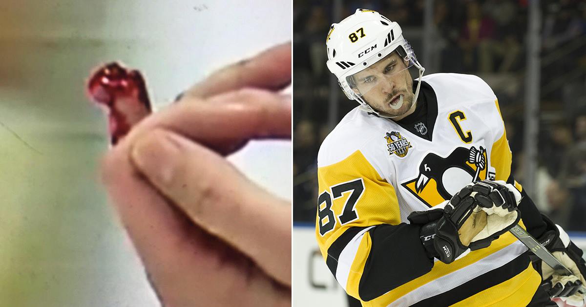 Breaking: Update on Methot following the Crosby slash is not good.