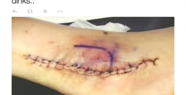 Curt Schilling tweets ghastly photo of &amp;amp;quot;Bloody Sock&amp;amp;quot; ankle. (PHOTOS)
