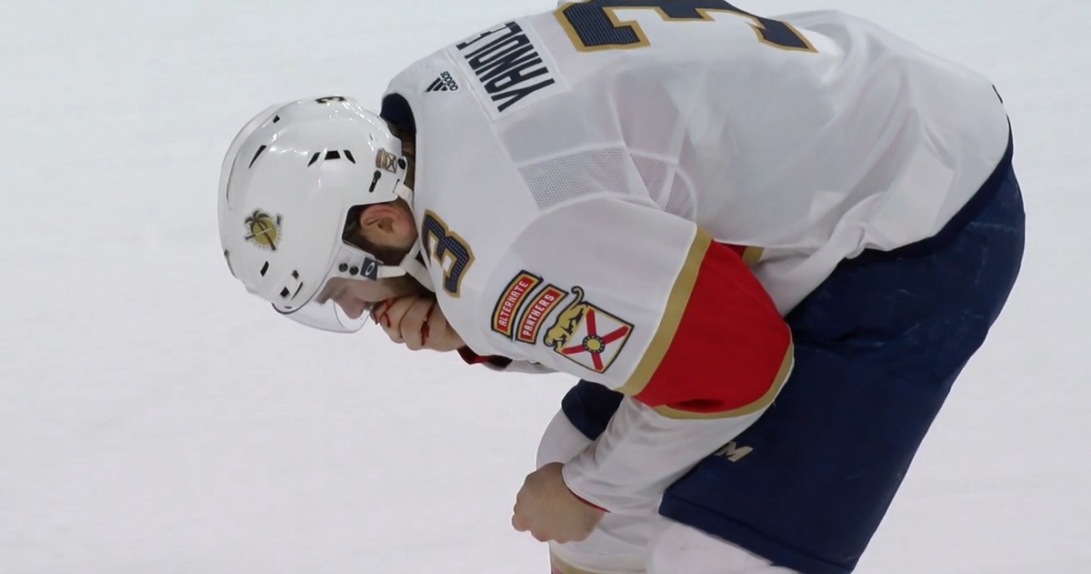 Keith Yandle loses 9 teeth in the blink of an eye.