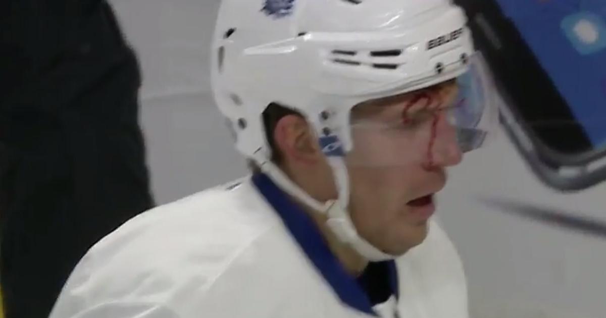 Neil destroys Hunwick with a monster him and leaves him a bloody mess.