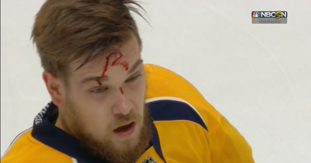 Breaking: Player ejected after nasty hit leaves his opponent a bloody mess.