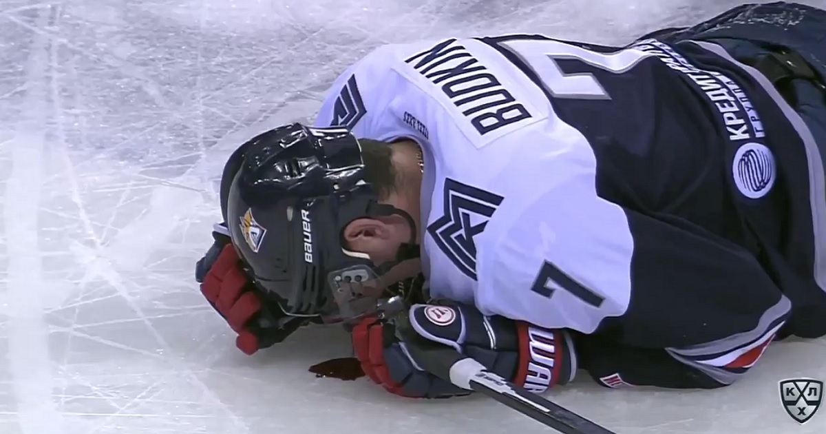 KHLer takes a huge hit, has blood gushing out of his eye.