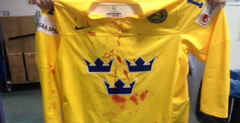 VIDEO: NHLer a bloody mess after vicious hit at World championship.