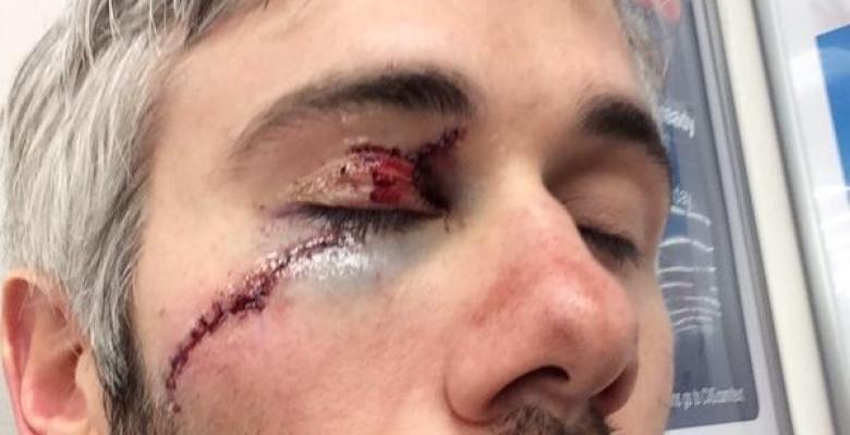 Drew Miller gives terrifying description of his eye injury.