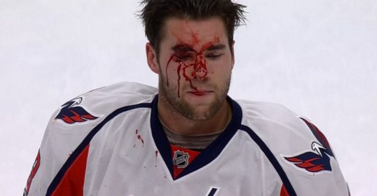 Brief but bloody fight leaves Wilson a mess tonight.