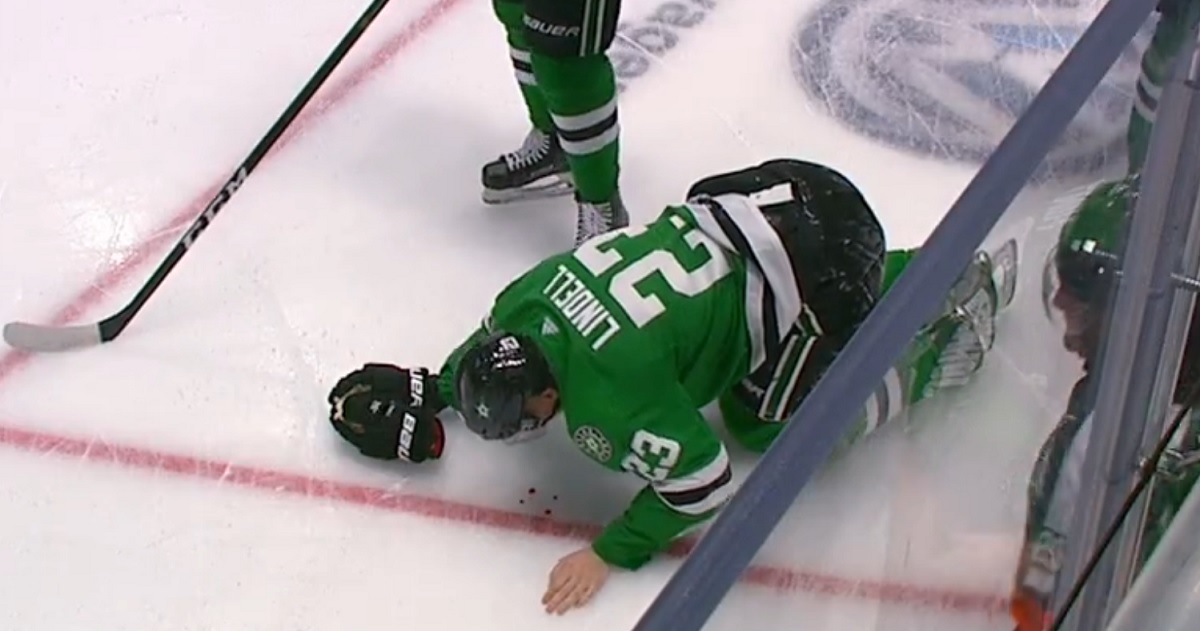 Esa Lindell takes a slapshot from Sidney Crosby to the face.