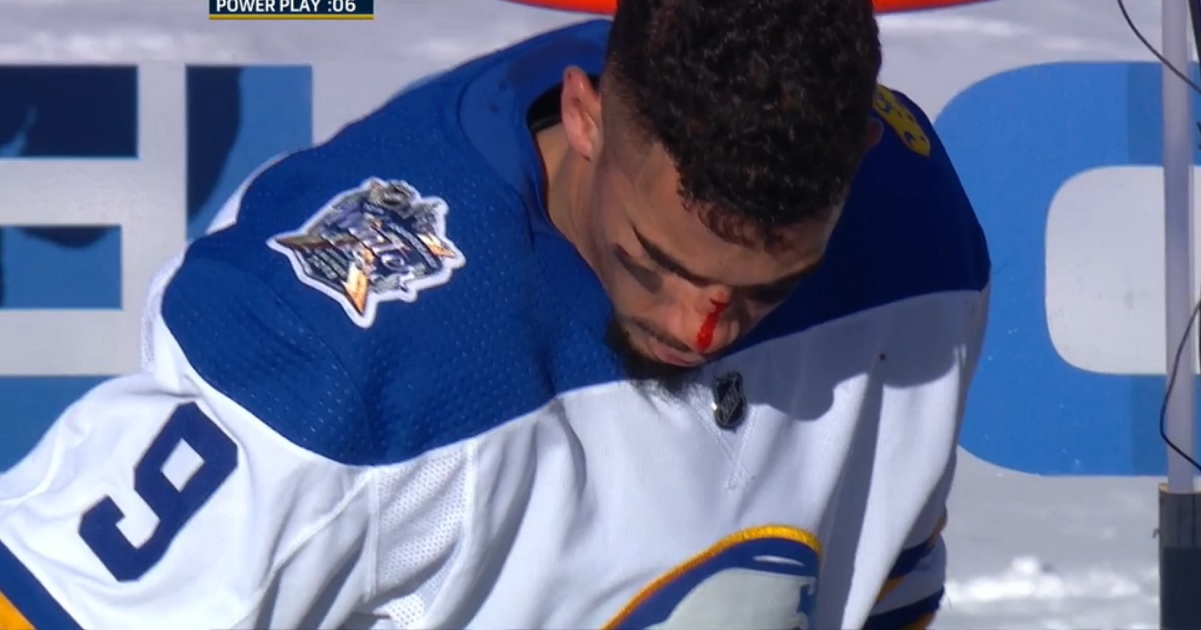 Kane eats a stick to the face, goes crashing head first into the boards.