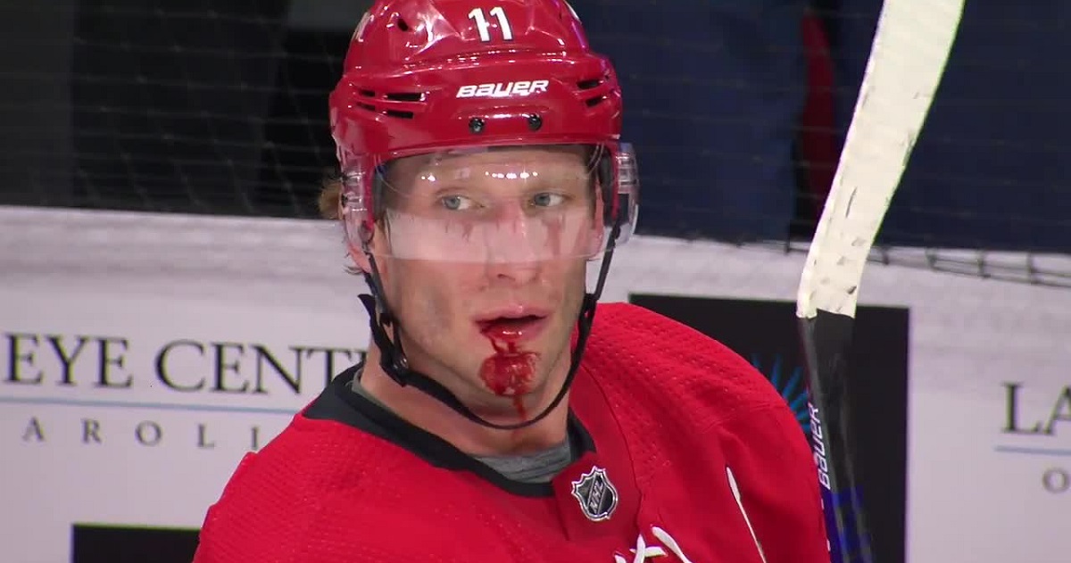 Jordan Staal busted open but goes unnoticed by NHL officials.