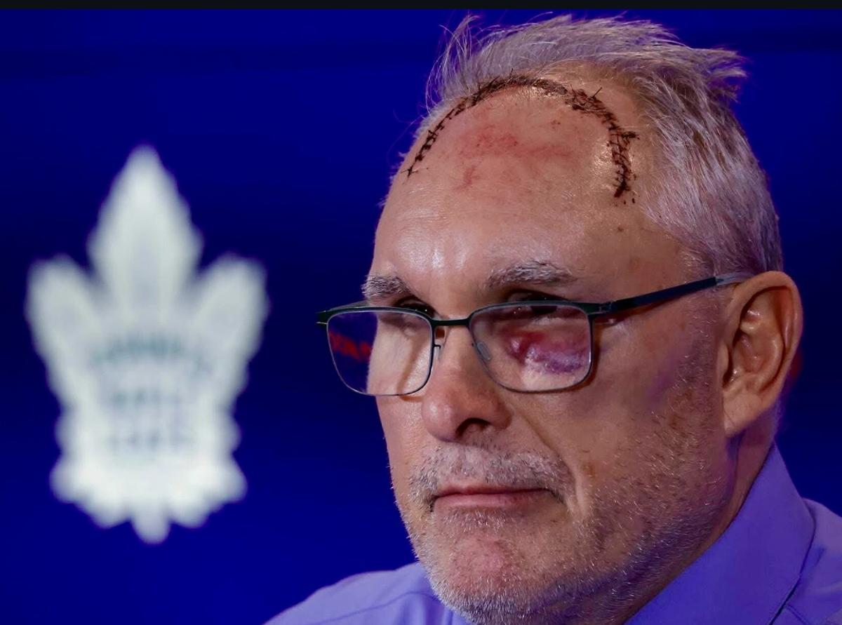 Craig Berube's nasty scar. 