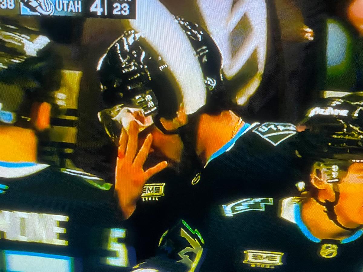 Sean Durzi, bleeding at the Utah bench. 